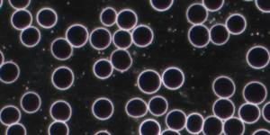 Dunkelfeld-Mikroskopie-Aufnahme von Blut, die große, runde rote Blutkörperchen (Makrozyten) zeigt, die im Kontext eines Vitamin-B-Mangels oder einer makrozytären Anämie interpretiert werden.