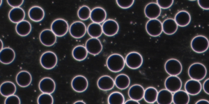 Dunkelfeld-Mikroskopie-Aufnahme von Blut, die große, runde rote Blutkörperchen (Makrozyten) zeigt, die im Kontext eines Vitamin-B-Mangels oder einer makrozytären Anämie interpretiert werden.