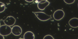 Dunkelfeld-Mikroskopaufnahme von Blut, die runde, normale rote Blutkörperchen und in der Mitte zwei bis drei zitronenförmige, verformte Zellen zeigt, die auf die Anwesenheit von Trichomonaden oder eine andere parasitische Infektion hinweisen können.