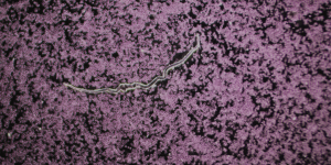 Mikroskopische Aufnahme einer Blutprobe, die eine langgestreckte, gewellte parasitäre Struktur (möglicherweise einen Fadenwurm oder eine Mikrofilare) vor einem Hintergrund aus rosa-violetten Blutzellen zeigt.