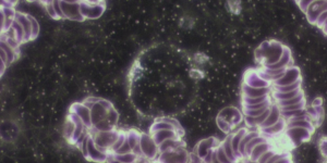 Mikroskopisches Bild einer Blutprobe mit Rouleaux-Formationen der roten Blutkörperchen. Im Zentrum ist eine große, ringförmige Struktur sichtbar, die als Parasit oder Wurmei im Blut interpretiert wird.